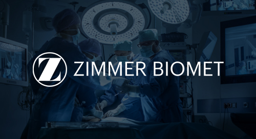 Achieving Improved DSO,  Efficiency